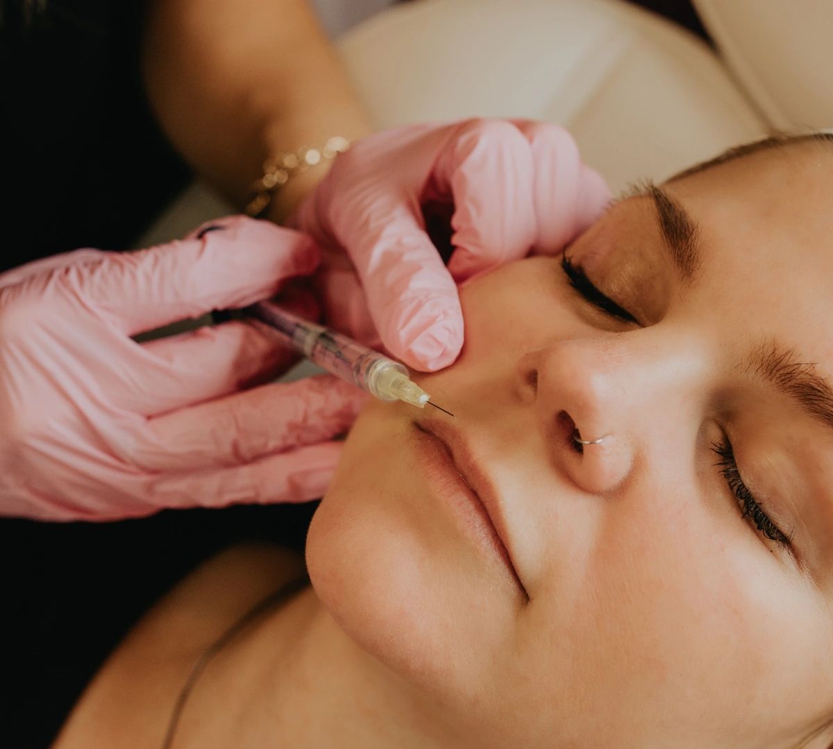 lip filler injection